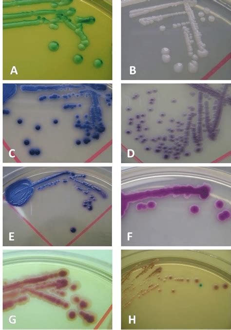 Colony Color On Chromagar Candida Showing Green C Albicans A Dark