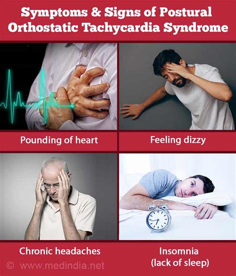 Evaluation Of Postural Tachycardia Syndrome (Pots) at Debora Joseph blog