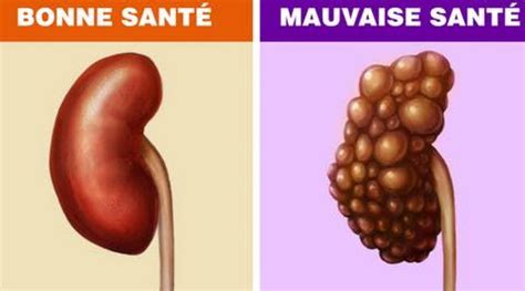 Des reins en mauvaise santé rendent lourd et fatigué 10 habitudes