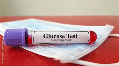 Laboratory Sample Tube Of Blood Glucose Level Test High Fasting Blood