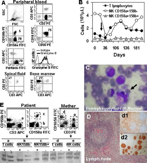 Data On The Patient With Hemophagocytic Lymphohistiocytosis A At Download Scientific Diagram