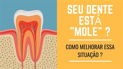 Dente mole O que fazer nessa situação YouTube