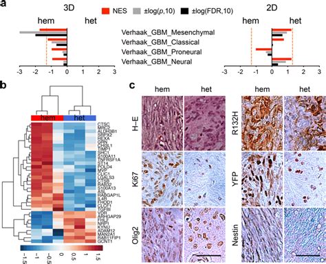 Loss Of Idh R H Heterozygosity Drives Glioma Progression A