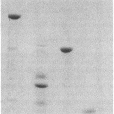 Sds Polyacrylamide Gel Electrophoresis Of Proteins Before And After