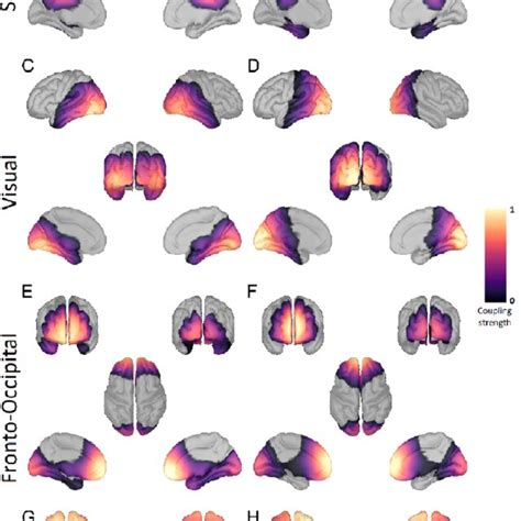 Resting State Networks Based On Parkinson Patients On Medication Shown