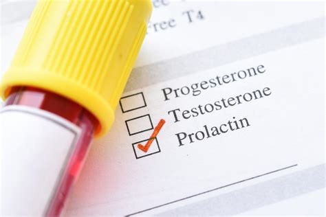 Prolactin Level Test High Levels Low Levels And When To Measure