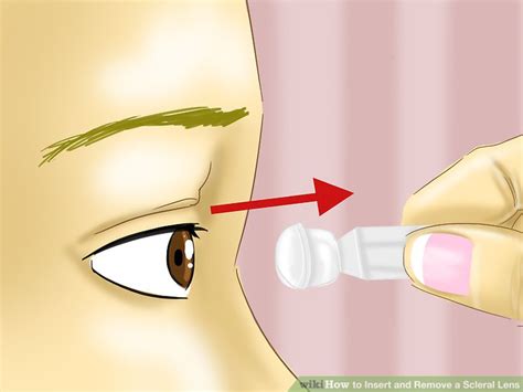 How To Insert And Remove A Scleral Lens With Pictures WikiHow