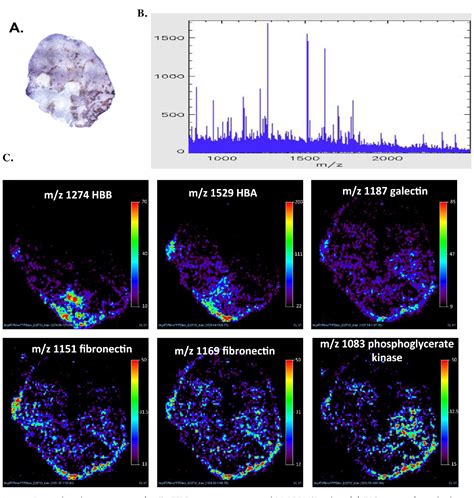 Figure 1 From Identification Of Hypoxia Regulated Proteins Using Maldi Mass Spectrometry Imaging