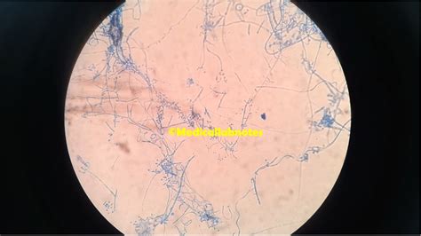 Trichophyton Mentagrophytes Introduction Morphology Pathogen