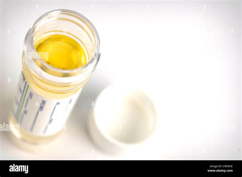 urine test sample Stock Photo - Alamy