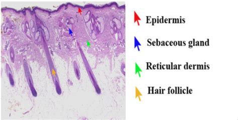 Fcm Dermatology High Yield Flashcards Quizlet