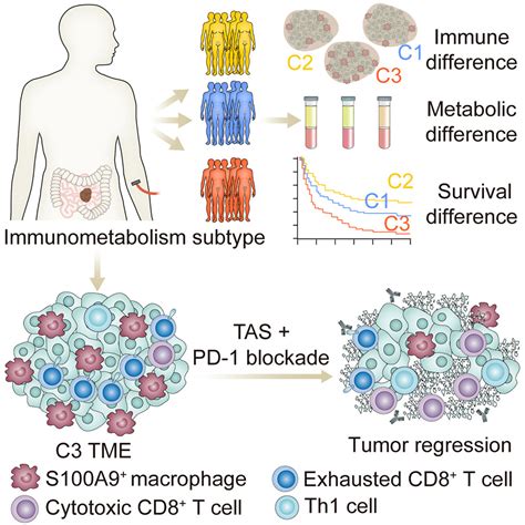 An Immunometabolism Subtyping System Identifies S100a9 Macrophage As