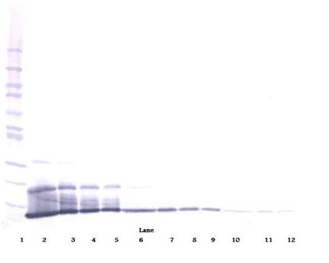 CXCL16 Polyclonal Antibody Biotin PeproTech Invitrogen 50 μg