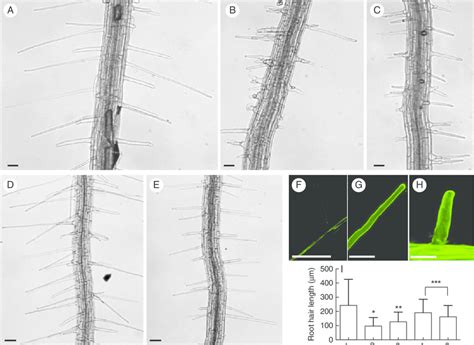 The Prp3 Vti13 Double Mutant Suppresses The Root Hair Phenotypes Of The