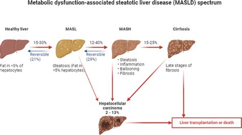 Full Article From Nafld To Masld What Does It Mean