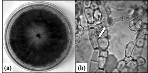 A Colony Of R Solani On Pda And B Normal Branched Hyphae White