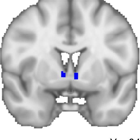 The Bed Nucleus Of The Stria Terminalis BST Seed Blue Coronal