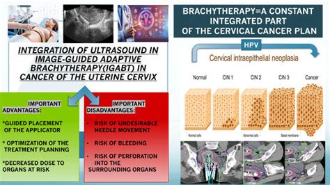 Bioengineering Free Full Text Integration Of Ultrasound In Image Guided Adaptive