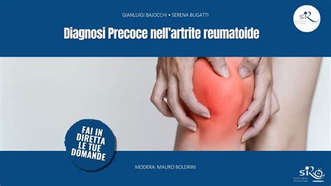 Diagnosi Precoce Nell Artrite Reumatoide Youtube