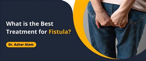 What is the best treatment for fistula?