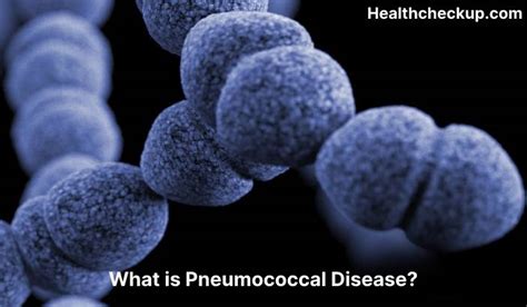 Pneumococcal disease - Symptoms, Diagnosis, Treatment, Prevention ...