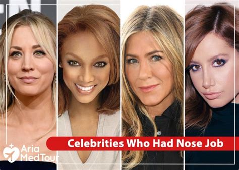 Celebs Who Admitted They Got Nose Job Ariamedtour