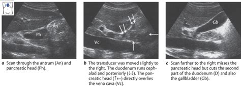 Pancreas Radiology Key