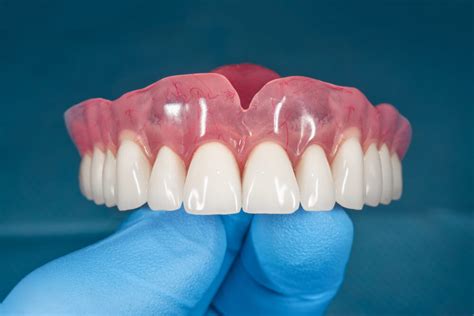 Dentures Adept Dental Group