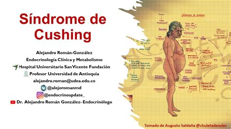 Qu Es El S Ndrome De Cushing Enfoque Diag Stico Y Tratamiento Del