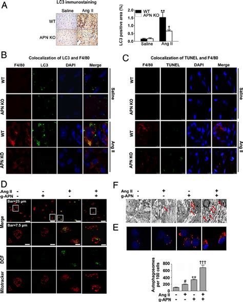 Apn Protects Against Ang Ii Induced Ros Generation And Macrophage