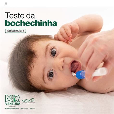 Teste da bochechinha investiga mais de 340 doenças raras tratáveis da