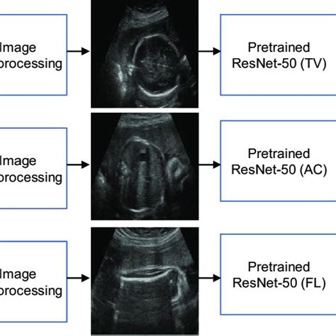 Training Process For Single Plane Estimation Of Gestational Age