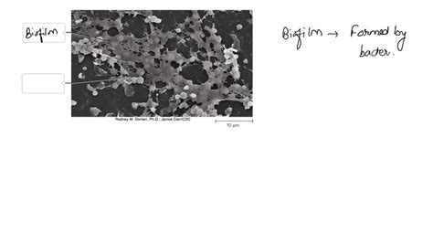 Solved Identify The Components In This Electron Micrograph Showing