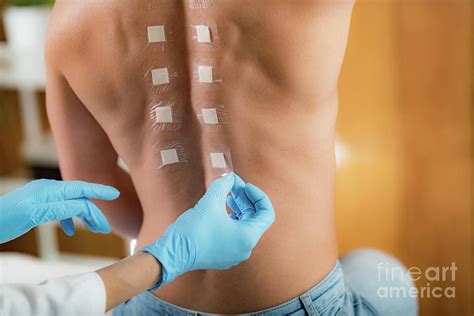 Doctor Doing Skin Allergy Test Photograph By Microgen Imagesscience