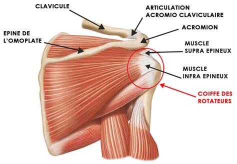 Réparation De La Coiffe Des Rotateurs Chirurgie De Lépaule à Nice