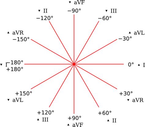 Eje Card Aco Como Calcular El Eje Card Aco En El Ekg Paso A Paso