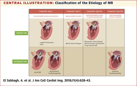 Mitral Valve Regurgitation In The Contemporary Era Insights Into