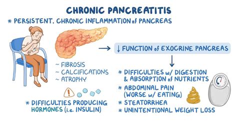 Chronic Pancreatitis Video And Meaning Osmosis