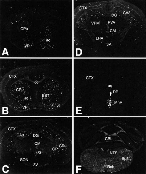 Mapping Of Vglut Mrna Expression In Coronal Sections Through The Mouse