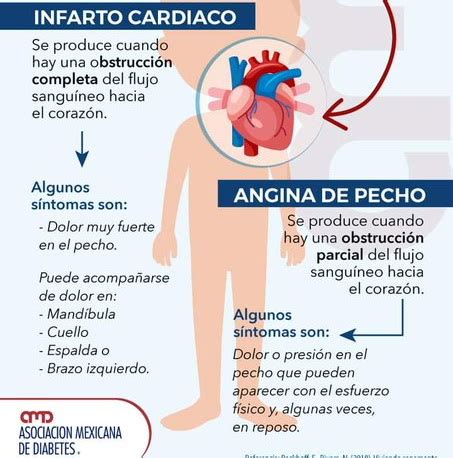 La Diabetes Mellitus Alcanz Un M Ximo Hist Rico En Yucat N Durante