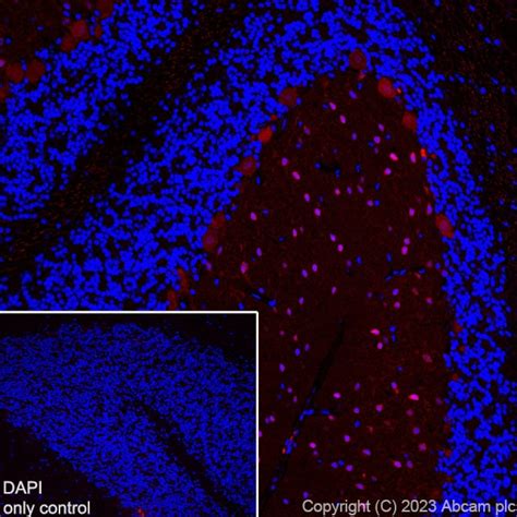 Recombinant Alexa Fluor Anti Parvalbumin Antibody Epr