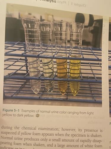 Physical Examination Of Urine Flashcards Quizlet
