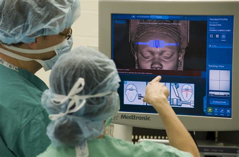 Medtronic Ct Sinus Protocol Captions Beautiful