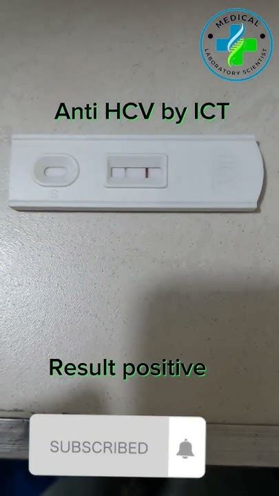 Hepatitis C Antibody Test Hcv Positive Hepatitis C Virus Hcv Test Hepatitis C Virus