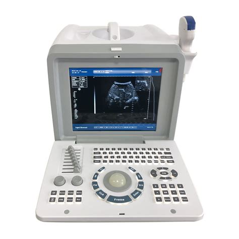 Medical Equipment Full Digital Bw Portable Ultrasonic Diagnostic System