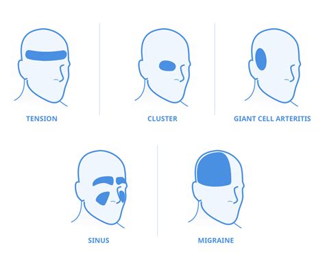 Types Of Headaches Symptoms Treatment Options Unilab