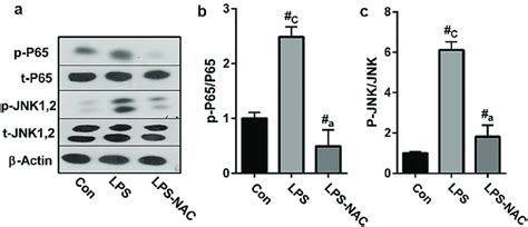 The effect of NAC on the phosphorylation of JNK MAPK and P65 NF κB in