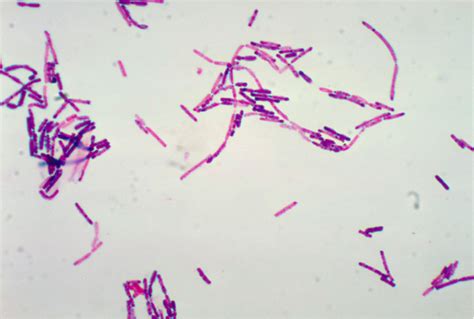 Bacillus cereus | Mechanisms of Pathogenicity