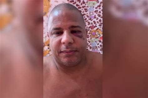 sinais de agressão Marcelinho Carioca diz em vídeo que foi