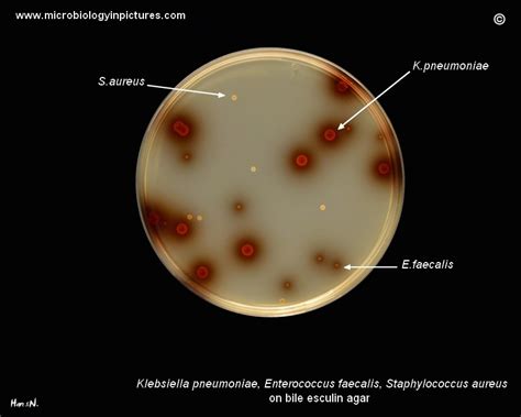 Klebsiella Pneumoniae Colony Morphology On Bile Esculin Agar Typical